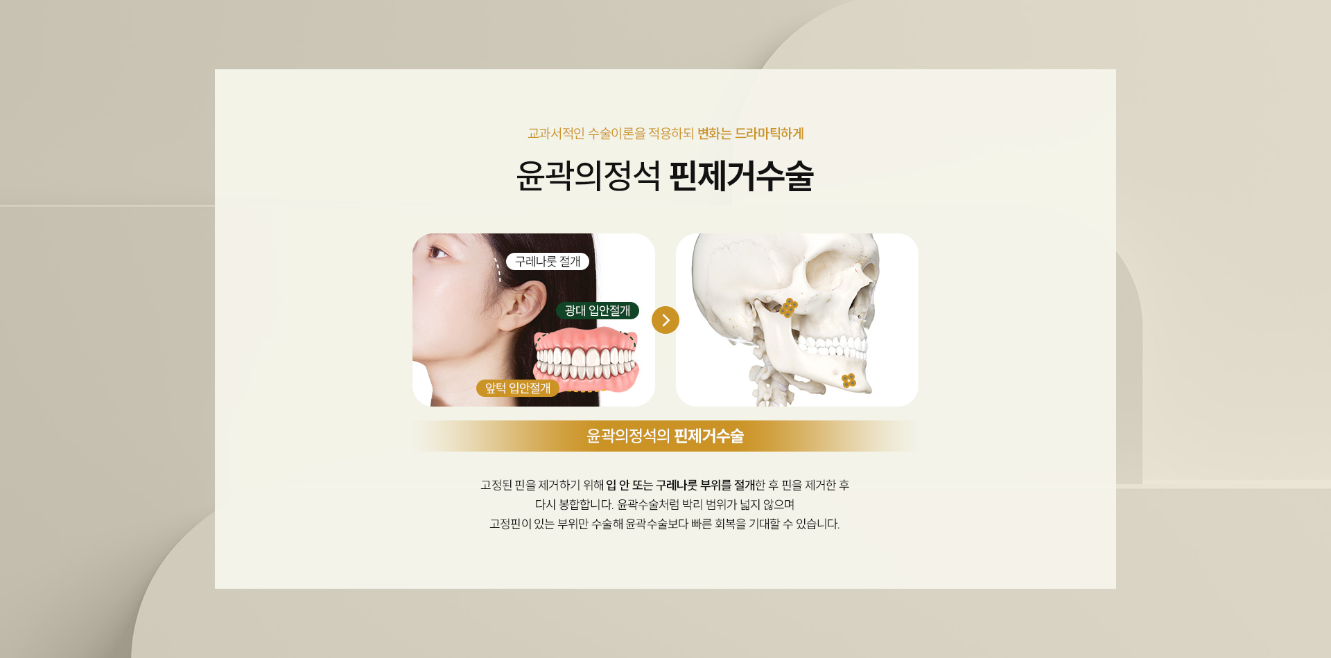 핀제거 02