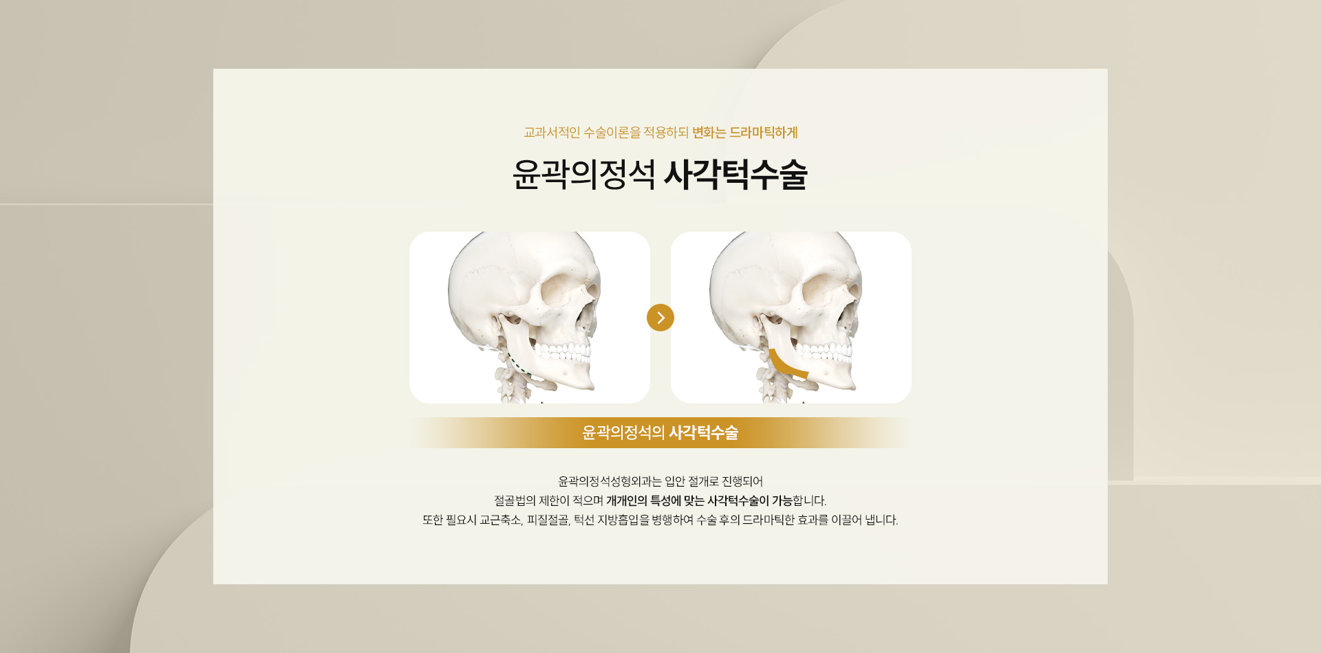 사각턱수술 02