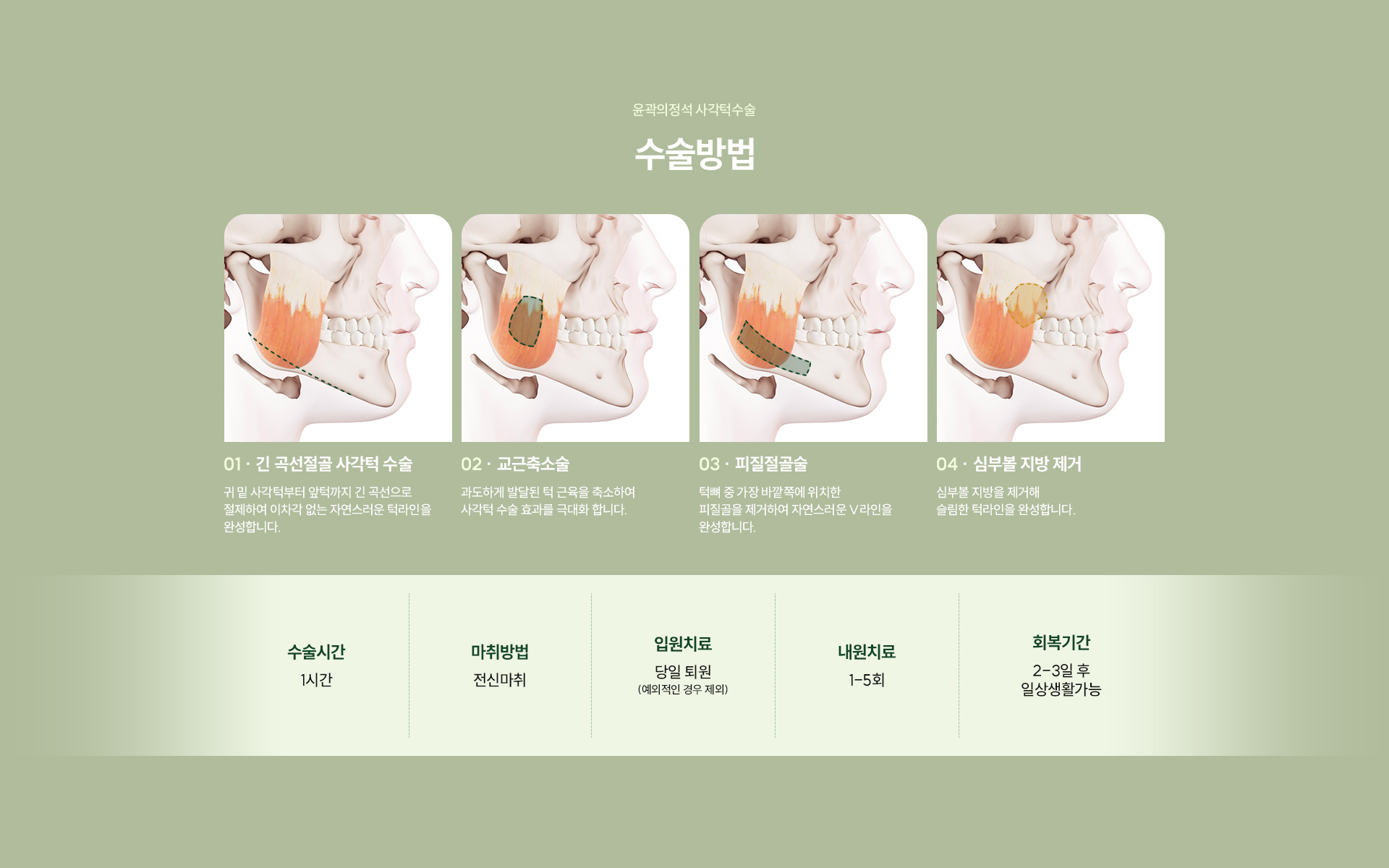 사각턱수술 03