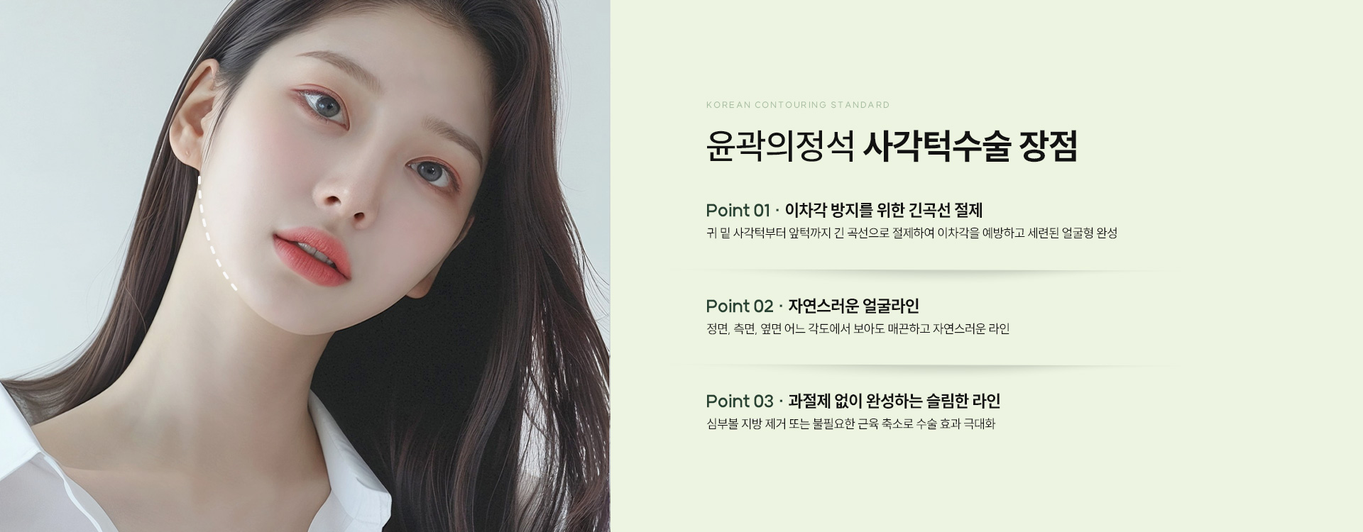 사각턱수술 06